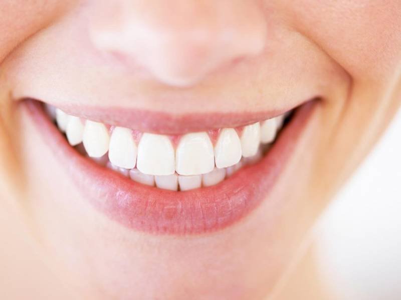Dental Aesthetics (Gingivoplasty)