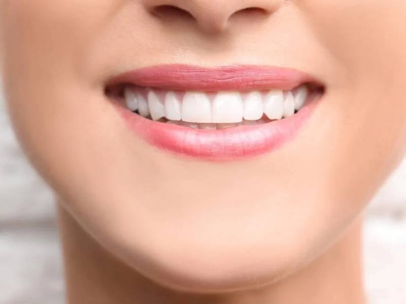 Dental Bonding: Factors Affecting Cost and Value