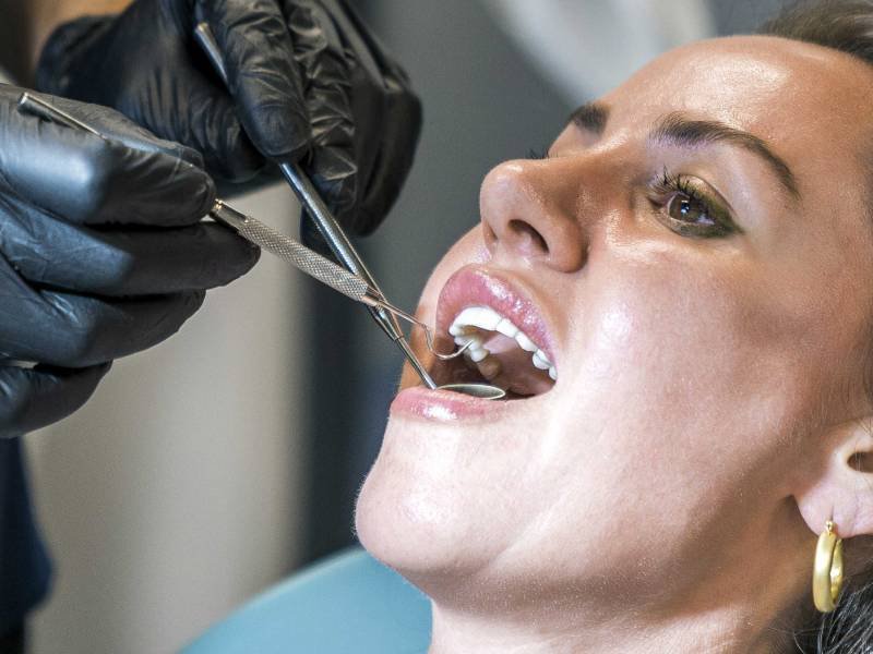 Gum Abscess: Causes, Symptoms, and Treatment