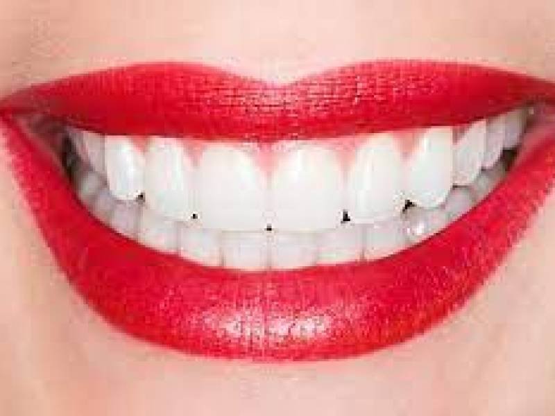 Surgery For An Ideal Smile
