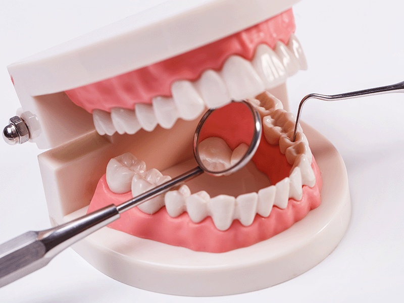 Total Dental Prosthesis
