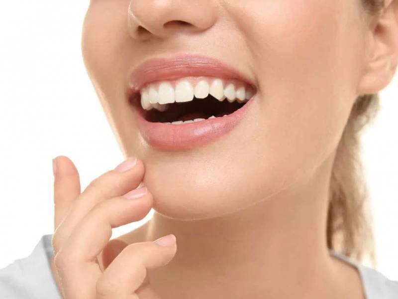 What is Composite Bonding?
