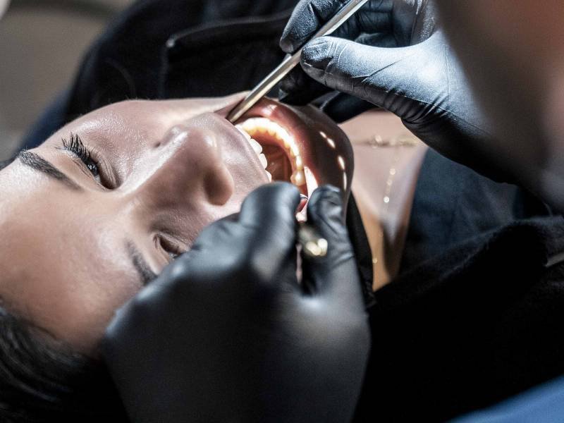 What is Dental Abscess?