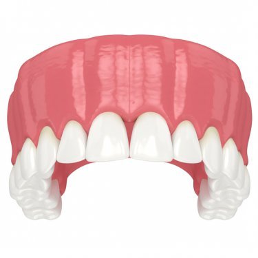 Upper Jaw