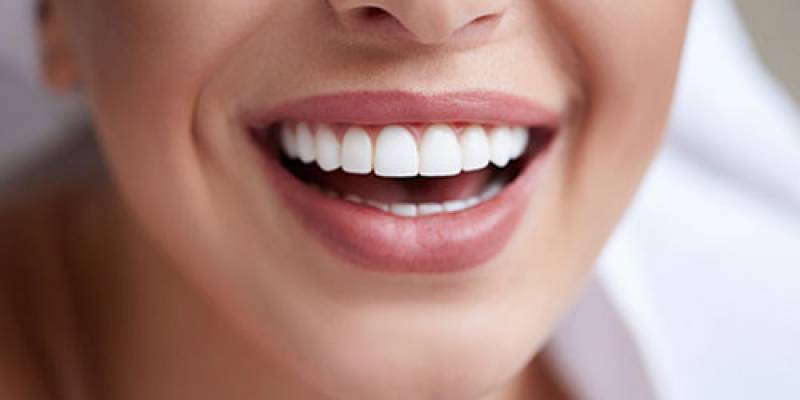 Unlock Your Perfect Smile: Exploring Dental Cosmetic Procedures in Turkey