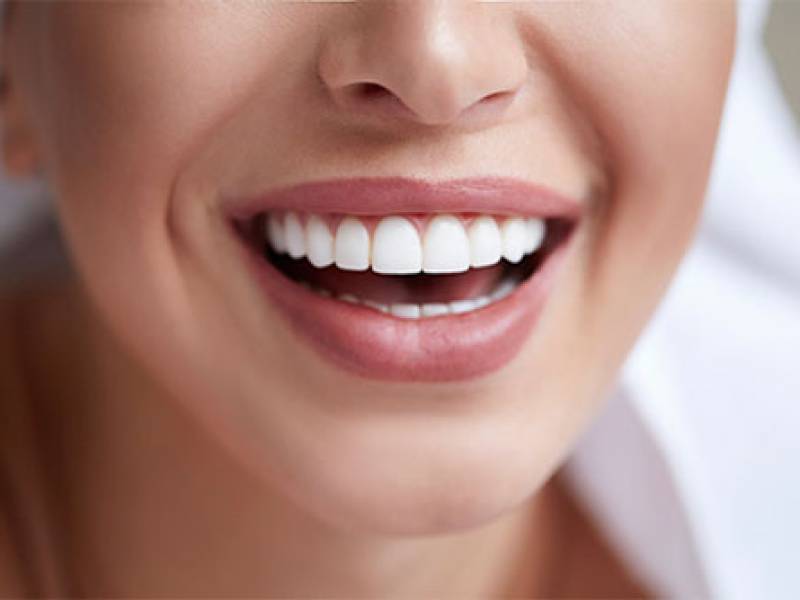 Unlock Your Perfect Smile: Exploring Dental Cosmetic Procedures in Turkey