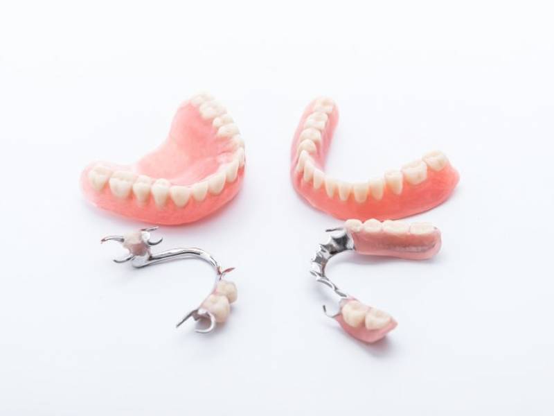 Dental Prosthesis Should Be Fixed or Removable?