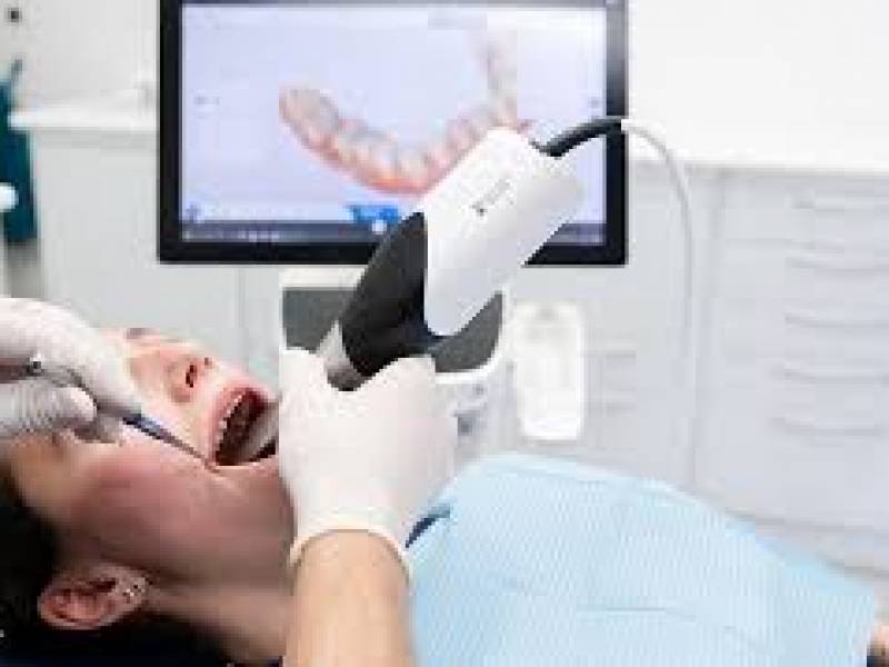 Dental What is CAD CAM? How Is It Applied?