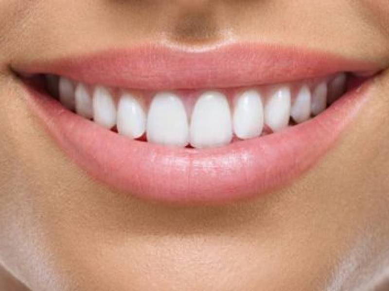 Healthier Teeth with Zirconium and Lamina Veneers!