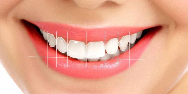 How Is Smile Design Applied?