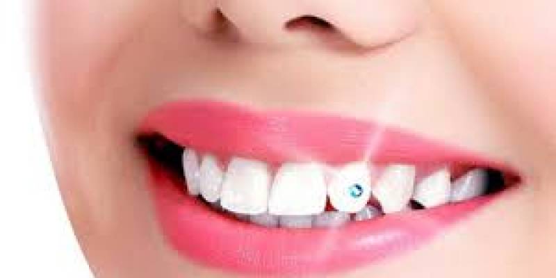 How To Remove Dental Crystal?