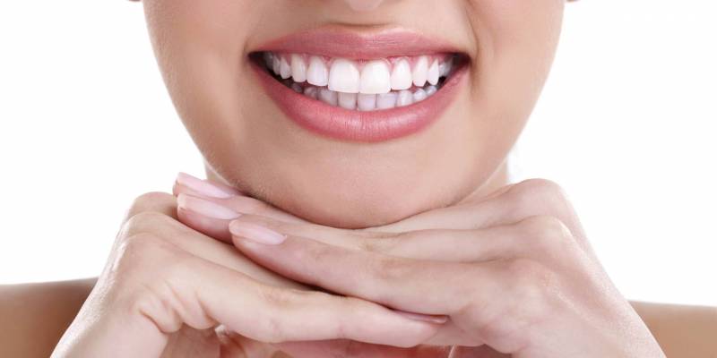 Is Teeth Whitening Permanent?