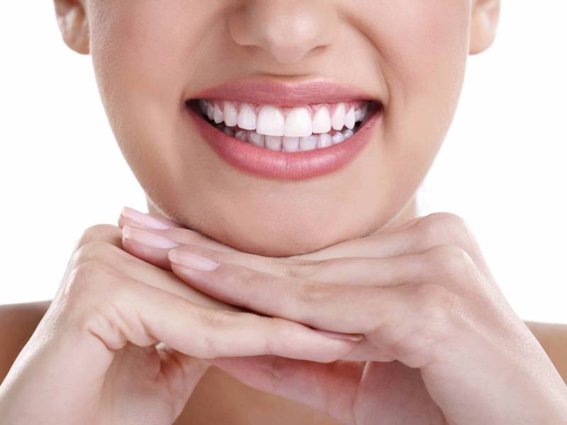 Is Teeth Whitening Permanent?