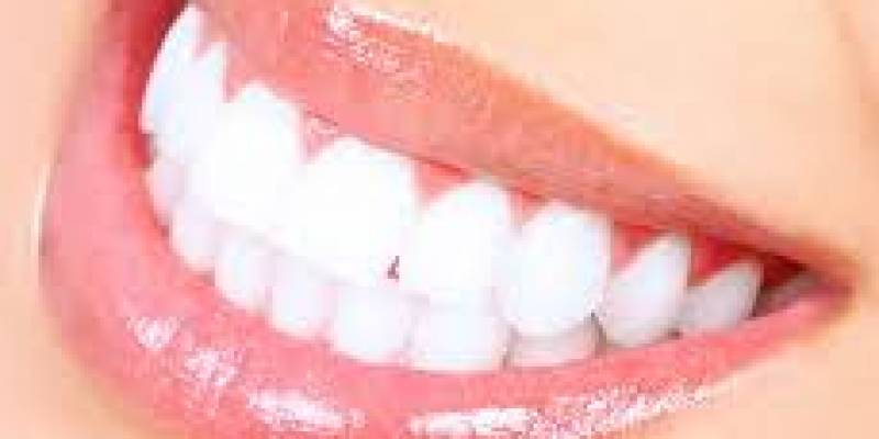 Single Tooth Whitening