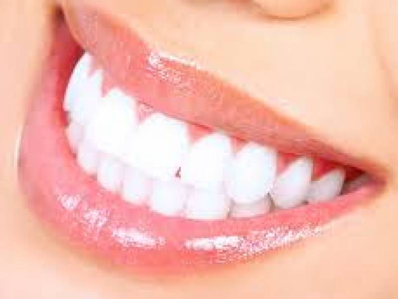 Single Tooth Whitening