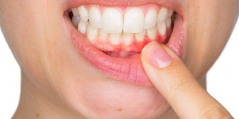 Swollen Gum Behind Back Tooth: Causes and Treatment Options