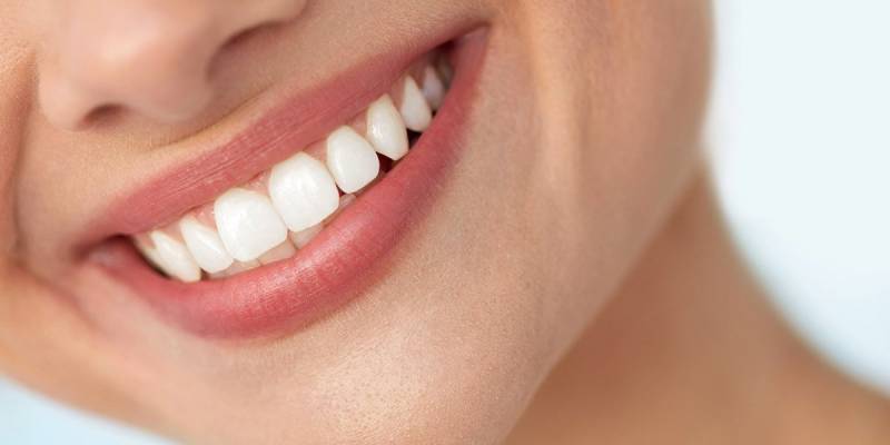 Combined Tooth Whitening