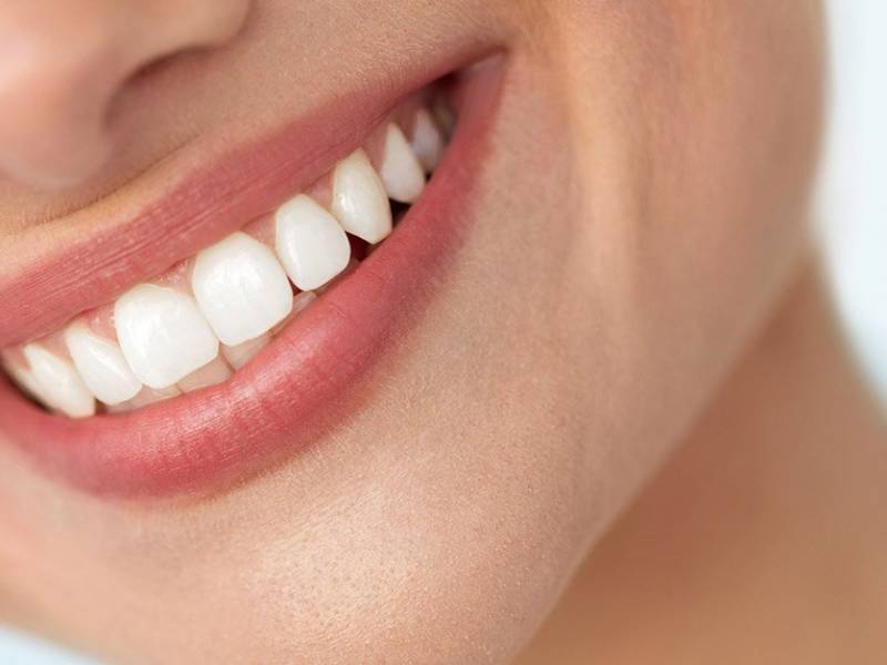 Combined Tooth Whitening