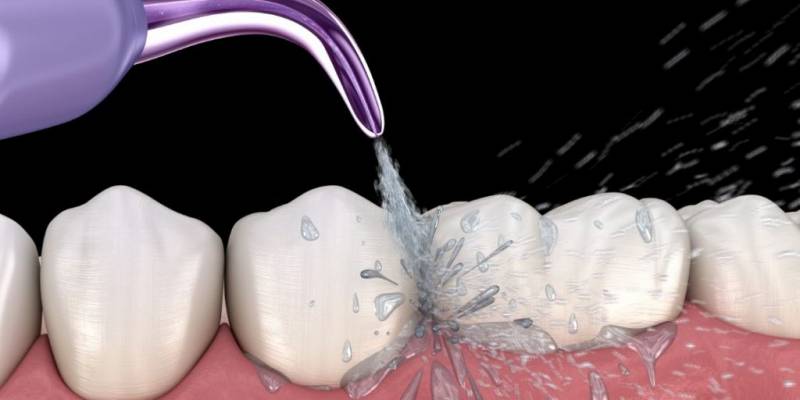 The Benefits of Air Flow Teeth Cleaning: An Effective Dental Hygiene Technique