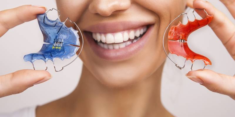 The Importance of Retainers in Maintaining a Beautiful Smile