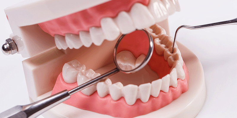 Total Dental Prosthesis